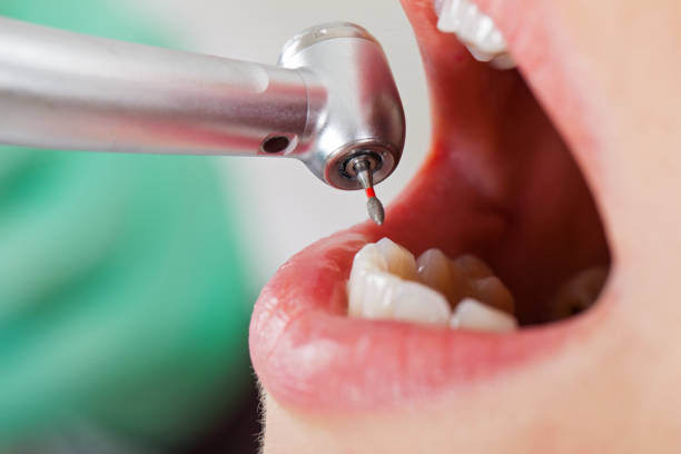 Best Emergency Denture Repair in Castroville, TX